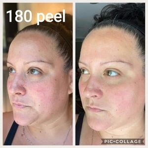 Facial Peel and Neutralizer Nu Skin 180°® AHA